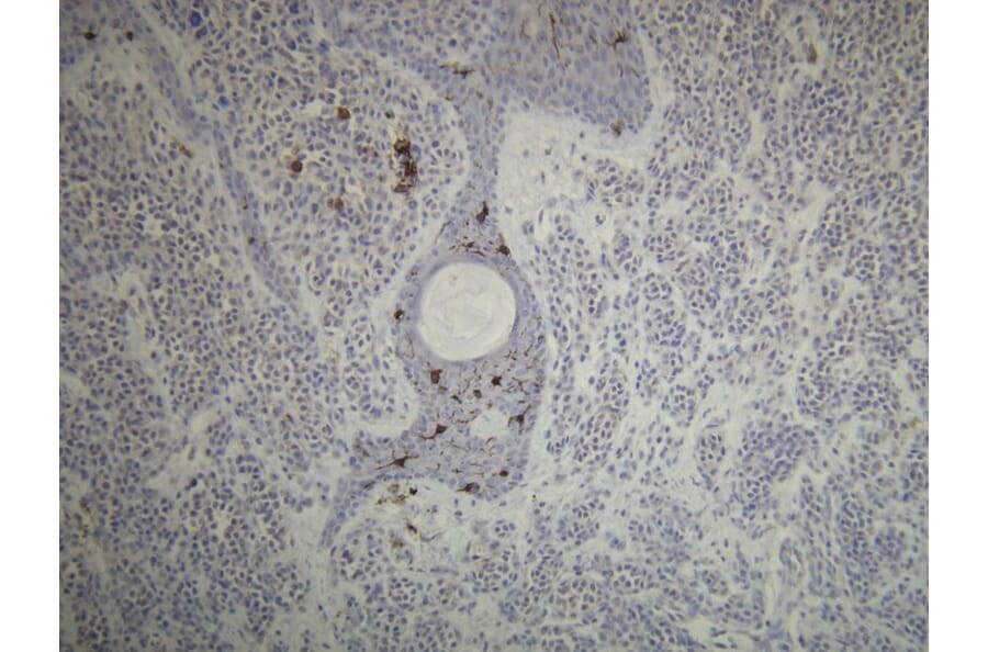 Immunohistochemistry - Anti-CD1a Antibody - Antibodies.com (A8211)