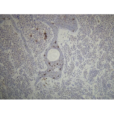 Immunohistochemistry - Anti-CD1a Antibody - Antibodies.com (A8211)