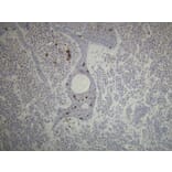 Immunohistochemistry - Anti-CD1a Antibody - Antibodies.com (A8211)