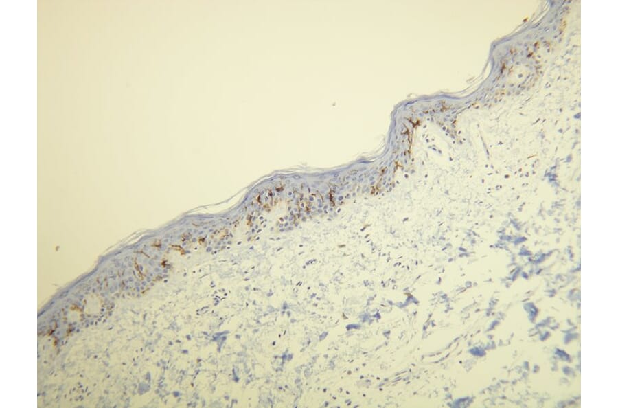 Immunohistochemistry - Anti-CD1a Antibody - Antibodies.com (A8211)