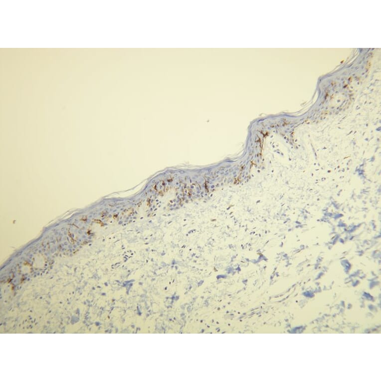 Immunohistochemistry - Anti-CD1a Antibody - Antibodies.com (A8211)