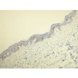 Immunohistochemistry - Anti-CD1a Antibody - Antibodies.com (A8211)