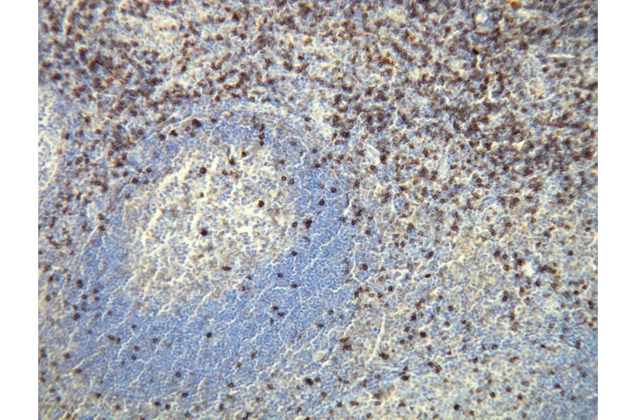 Immunohistochemistry - Anti-CD8 Antibody - Antibodies.com (A8213)