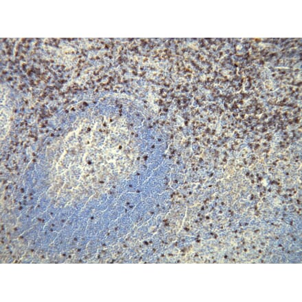 Immunohistochemistry - Anti-CD8 Antibody - Antibodies.com (A8213)