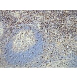 Immunohistochemistry - Anti-CD8 Antibody - Antibodies.com (A8213)