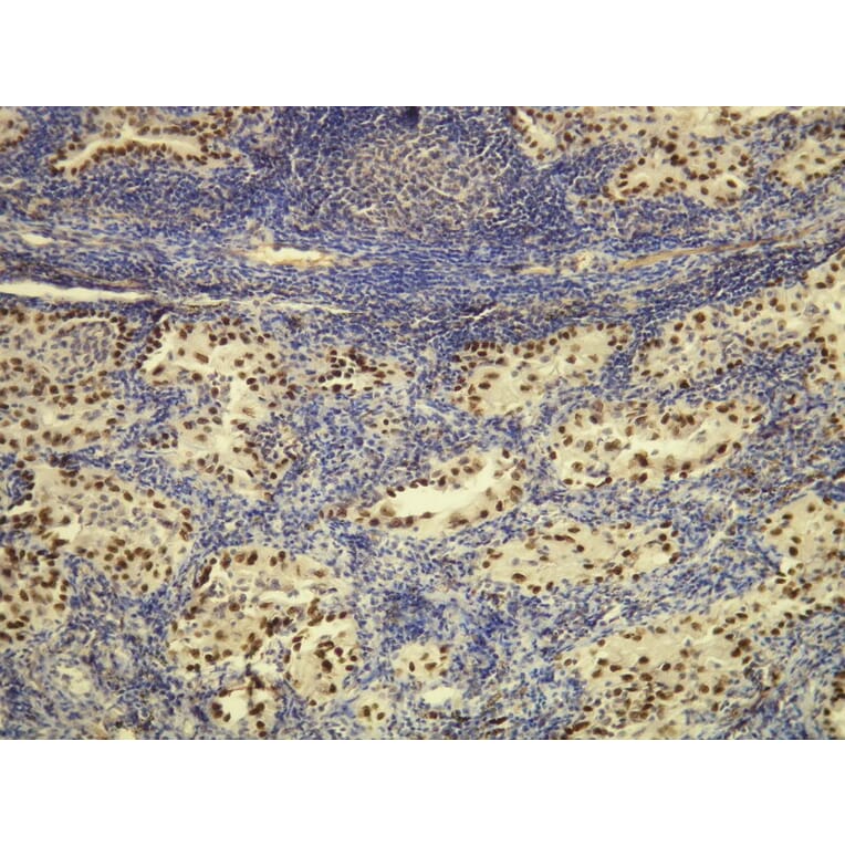 Immunohistochemistry - Anti-TTF-1 Antibody - Antibodies.com (A8214)