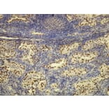 Immunohistochemistry - Anti-TTF-1 Antibody - Antibodies.com (A8214)
