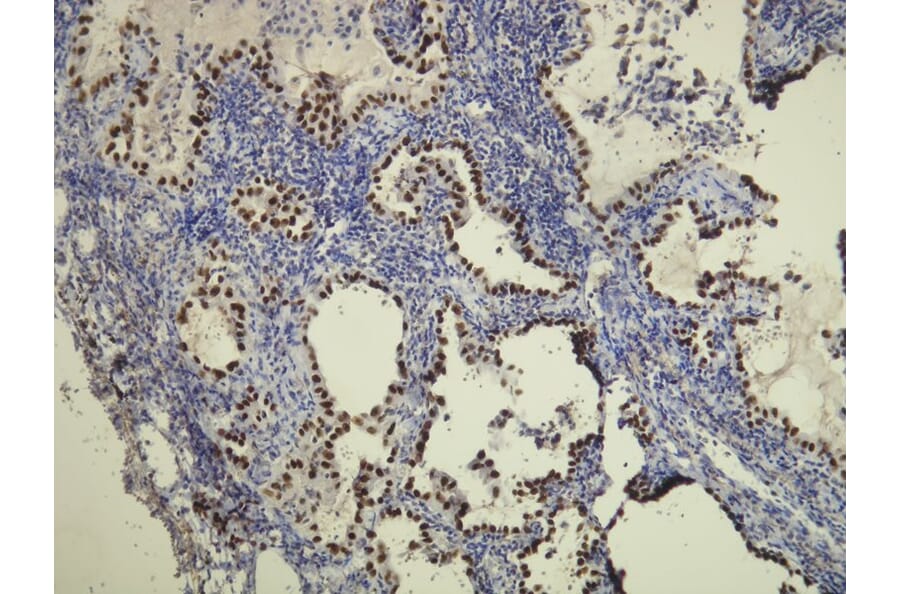 Immunohistochemistry - Anti-TTF-1 Antibody - Antibodies.com (A8214)