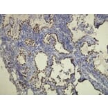 Immunohistochemistry - Anti-TTF-1 Antibody - Antibodies.com (A8214)