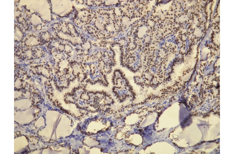 Immunohistochemistry - Anti-TTF-1 Antibody - Antibodies.com (A8214)