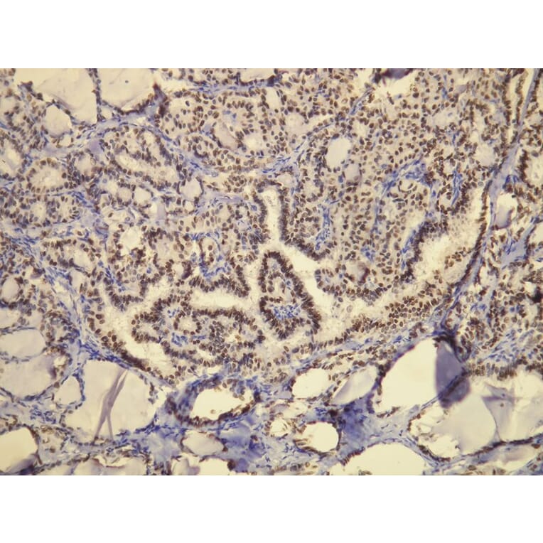 Immunohistochemistry - Anti-TTF-1 Antibody - Antibodies.com (A8214)