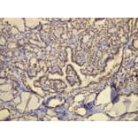 Immunohistochemistry - Anti-TTF-1 Antibody - Antibodies.com (A8214)
