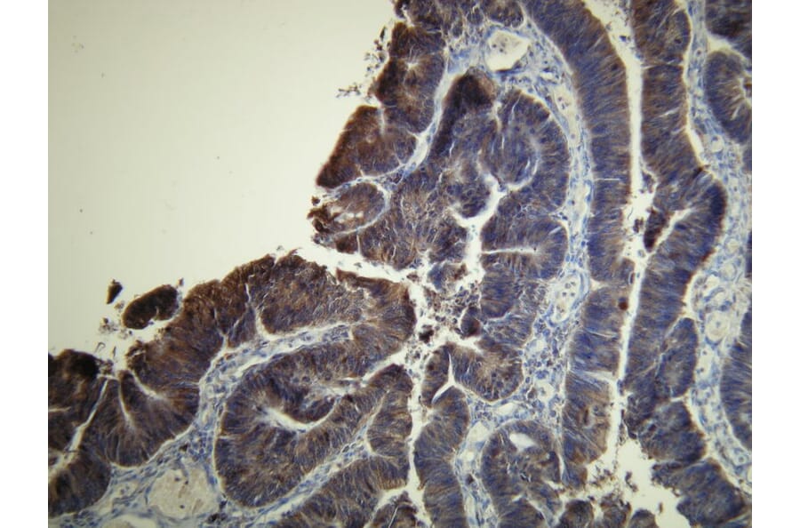 Immunohistochemistry - Anti-EGFR Antibody - Antibodies.com (A8215)