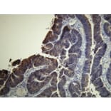 Immunohistochemistry - Anti-EGFR Antibody - Antibodies.com (A8215)