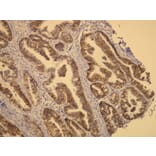 Immunohistochemistry - Anti-CerbB2 Antibody - Antibodies.com (A8216)