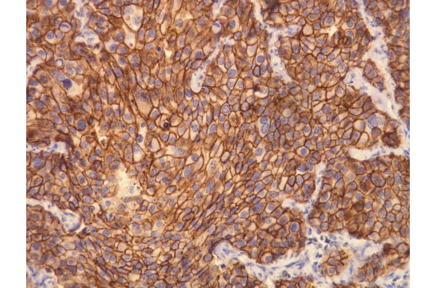 Immunohistochemistry - Anti-CerbB2 Antibody - Antibodies.com (A8216)