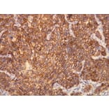 Immunohistochemistry - Anti-CerbB2 Antibody - Antibodies.com (A8216)