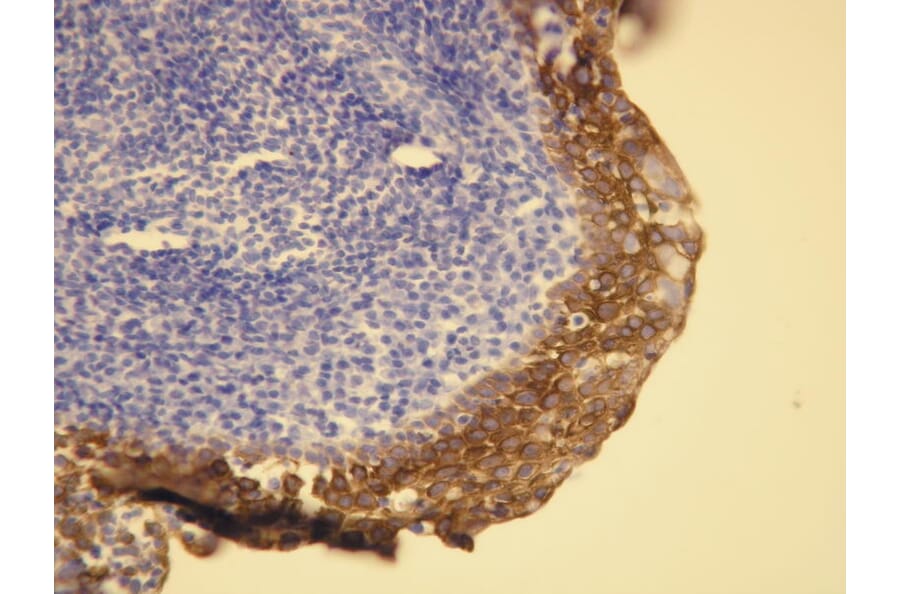 Immunohistochemistry - Anti-Cytokeratin 5 + 6 Antibody - Antibodies.com (A8217)