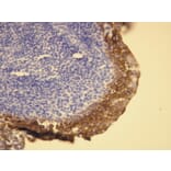 Immunohistochemistry - Anti-Cytokeratin 5 + 6 Antibody - Antibodies.com (A8217)