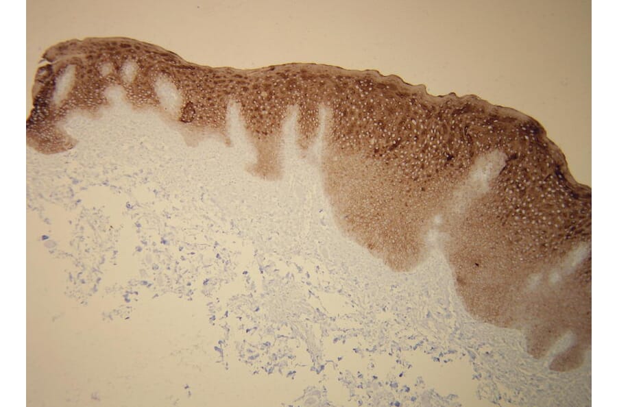 Immunohistochemistry - Anti-Cytokeratin 5 + 6 Antibody - Antibodies.com (A8217)