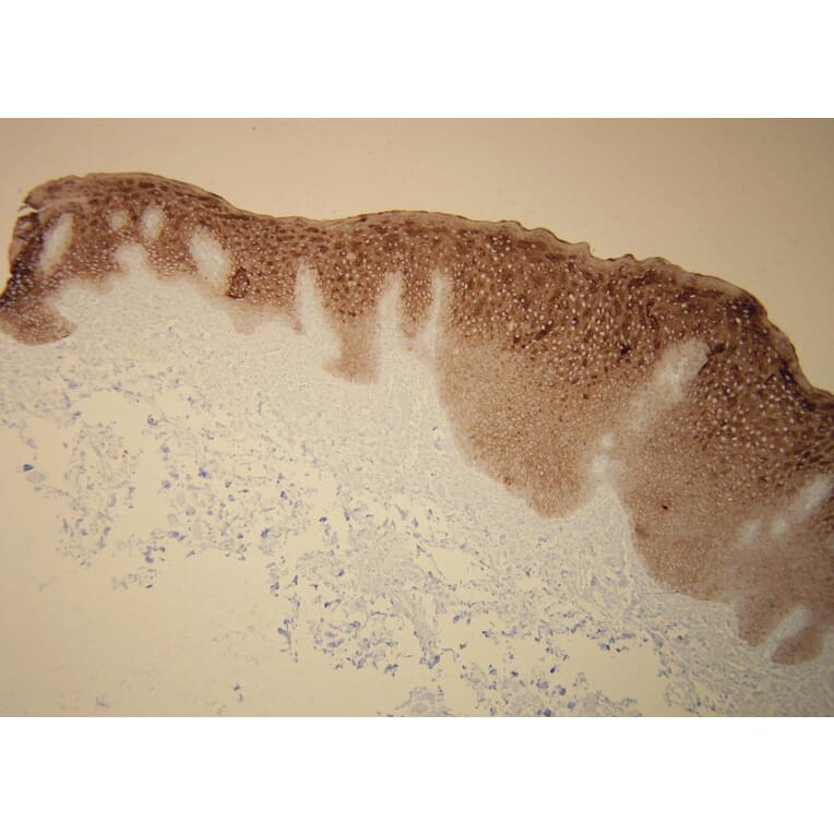 Immunohistochemistry - Anti-Cytokeratin 5 + 6 Antibody - Antibodies.com (A8217)