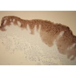 Immunohistochemistry - Anti-Cytokeratin 5 + 6 Antibody - Antibodies.com (A8217)