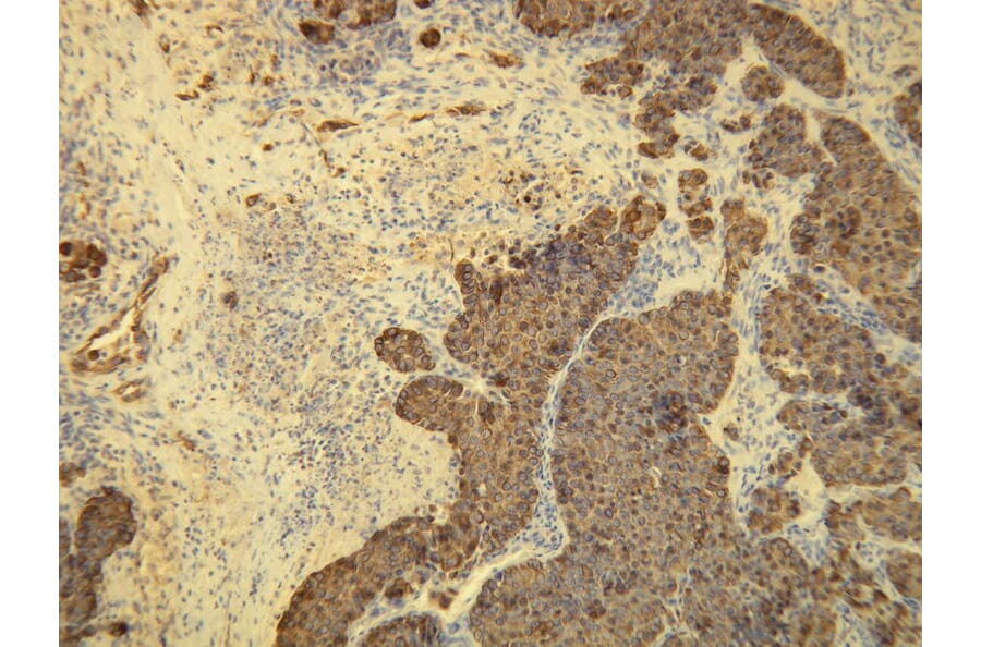 Immunohistochemistry - Anti-Cytokeratin 8 Antibody - Antibodies.com (A8218)