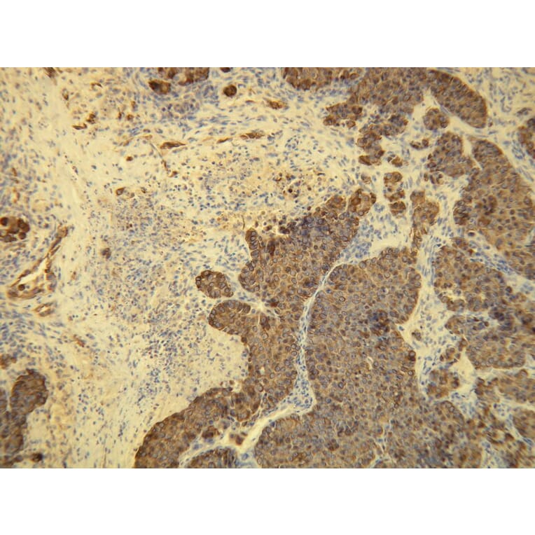 Immunohistochemistry - Anti-Cytokeratin 8 Antibody - Antibodies.com (A8218)