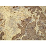 Immunohistochemistry - Anti-Cytokeratin 8 Antibody - Antibodies.com (A8218)