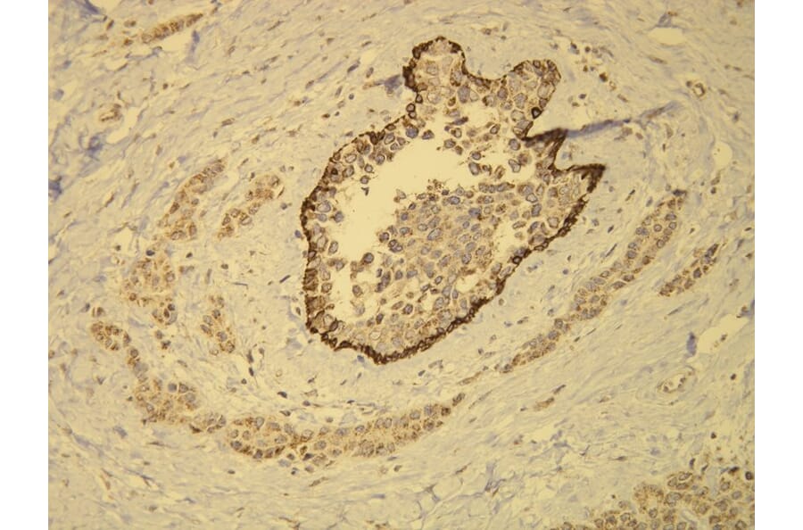 Immunohistochemistry - Anti-Cytokeratin 14 Antibody - Antibodies.com (A8219)
