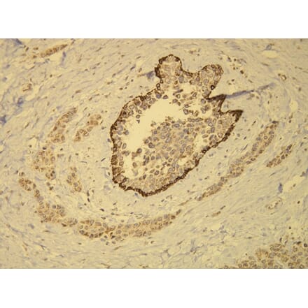 Immunohistochemistry - Anti-Cytokeratin 14 Antibody - Antibodies.com (A8219)