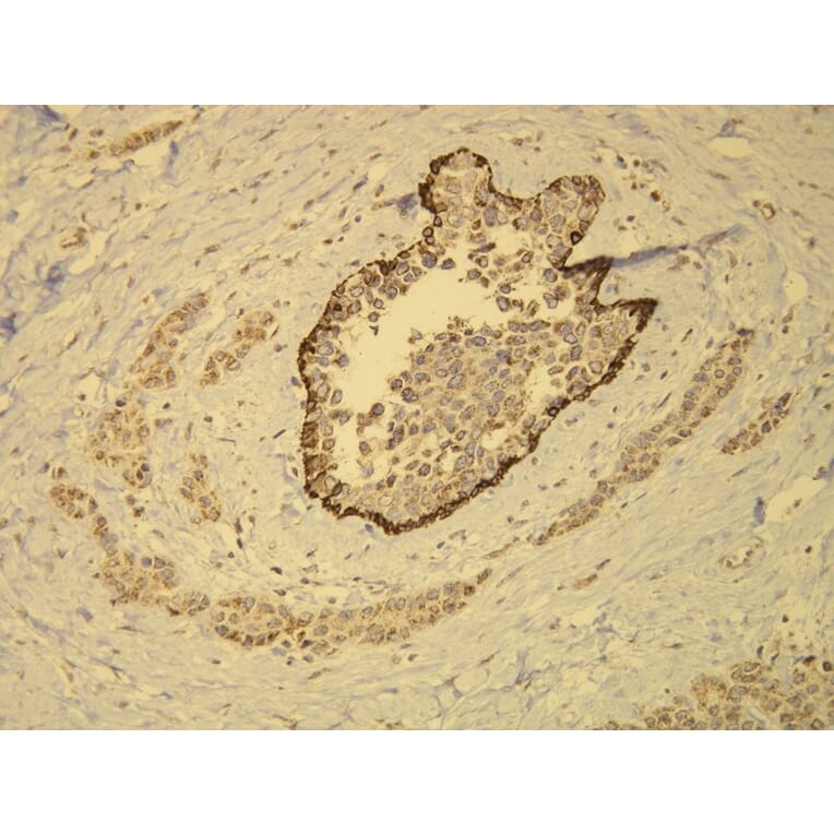 Immunohistochemistry - Anti-Cytokeratin 14 Antibody - Antibodies.com (A8219)