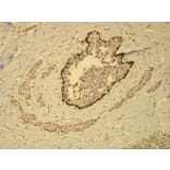 Immunohistochemistry - Anti-Cytokeratin 14 Antibody - Antibodies.com (A8219)