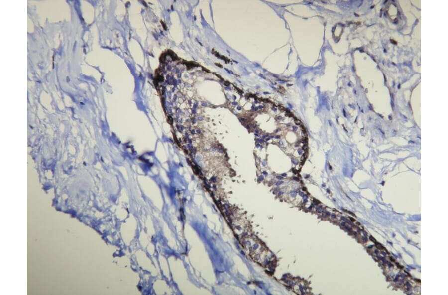 Immunohistochemistry - Anti-Cytokeratin 14 Antibody - Antibodies.com (A8219)