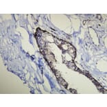 Immunohistochemistry - Anti-Cytokeratin 14 Antibody - Antibodies.com (A8219)