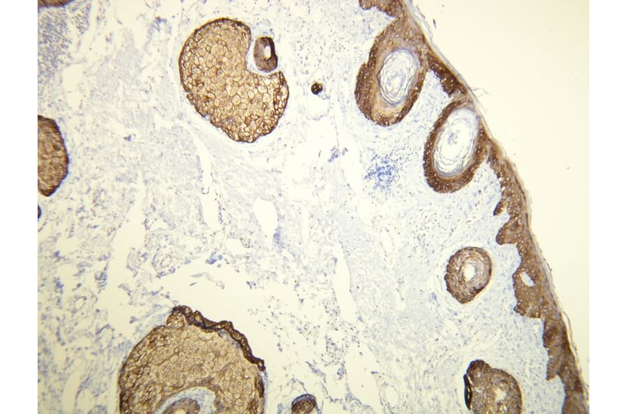 Immunohistochemistry - Anti-Cytokeratin 14 Antibody - Antibodies.com (A8219)