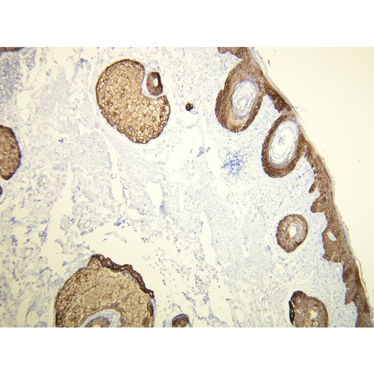 Immunohistochemistry - Anti-Cytokeratin 14 Antibody - Antibodies.com (A8219)