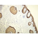 Immunohistochemistry - Anti-Cytokeratin 14 Antibody - Antibodies.com (A8219)