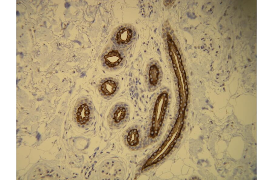 Immunohistochemistry - Anti-Cytokeratin 16 Antibody - Antibodies.com (A8220)