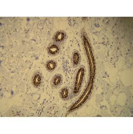 Immunohistochemistry - Anti-Cytokeratin 16 Antibody - Antibodies.com (A8220)