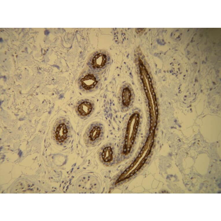 Immunohistochemistry - Anti-Cytokeratin 16 Antibody - Antibodies.com (A8220)