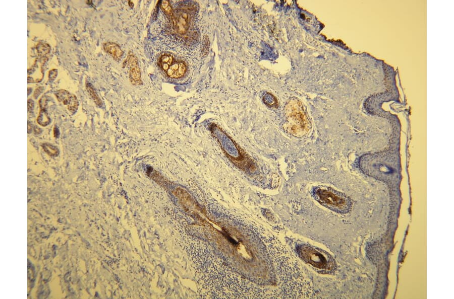 Immunohistochemistry - Anti-Cytokeratin 17 Antibody - Antibodies.com (A8221)