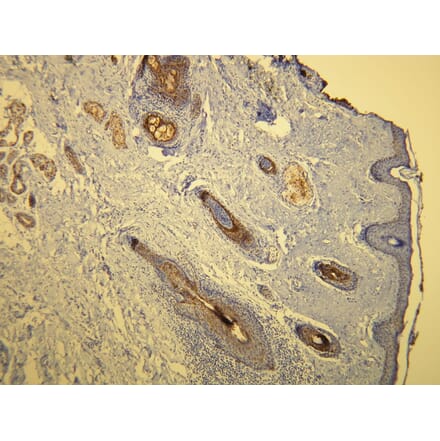 Immunohistochemistry - Anti-Cytokeratin 17 Antibody - Antibodies.com (A8221)