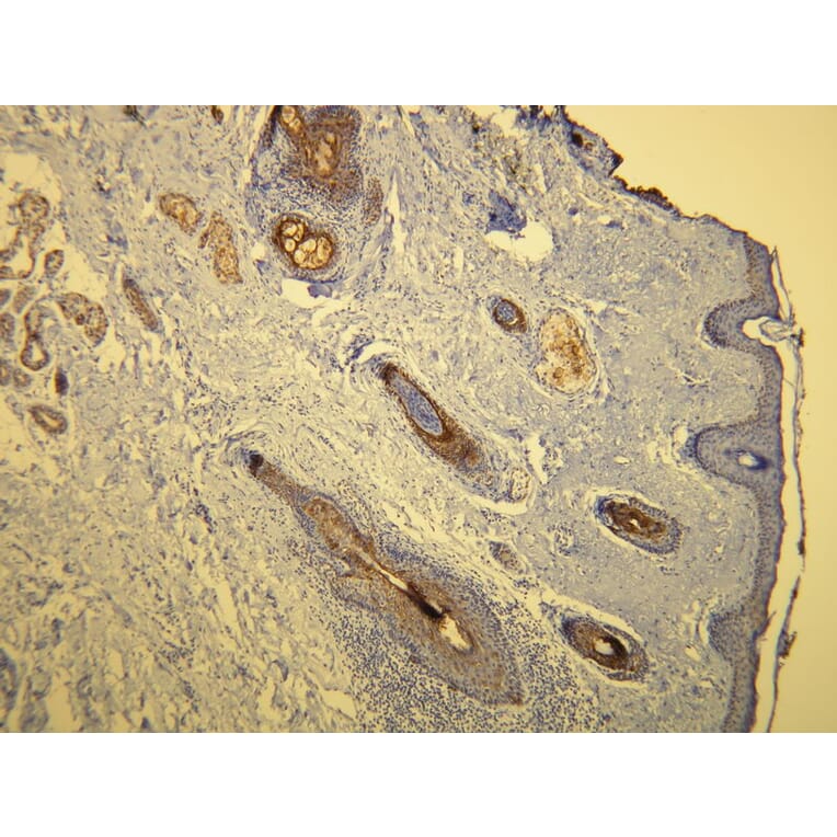 Immunohistochemistry - Anti-Cytokeratin 17 Antibody - Antibodies.com (A8221)