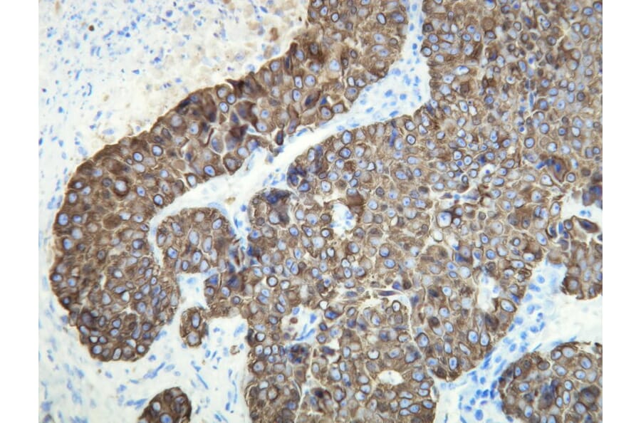 Immunohistochemistry - Anti-Cytokeratin 18 Antibody - Antibodies.com (A8222)