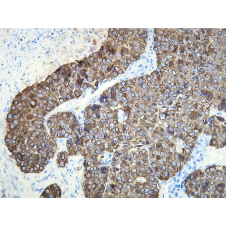 Immunohistochemistry - Anti-Cytokeratin 18 Antibody - Antibodies.com (A8222)