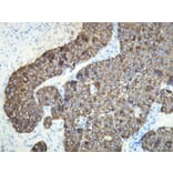 Immunohistochemistry - Anti-Cytokeratin 18 Antibody - Antibodies.com (A8222)