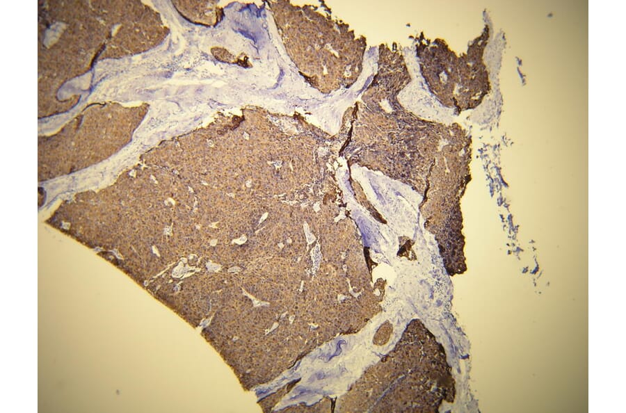 Immunohistochemistry - Anti-Cytokeratin 19 Antibody - Antibodies.com (A8223)