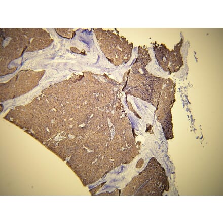 Immunohistochemistry - Anti-Cytokeratin 19 Antibody - Antibodies.com (A8223)