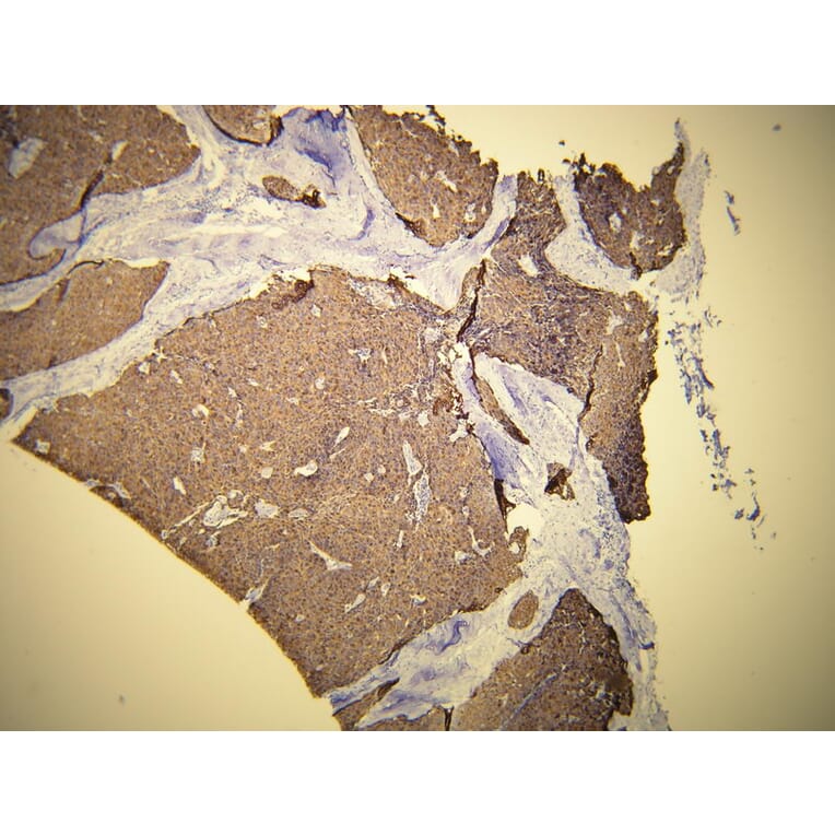 Immunohistochemistry - Anti-Cytokeratin 19 Antibody - Antibodies.com (A8223)